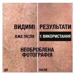 Лосьон для тела Neutrogena Інтенсивне відновлення 250 мл Фото 5