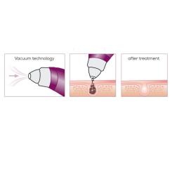 Массажер Beurer FC 41 Фото 6